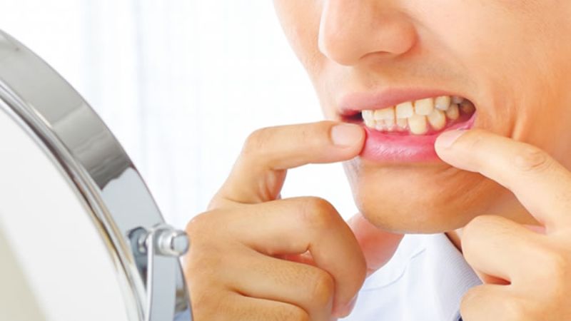 未来の口腔ケア: 最新虫歯治療技術と予防の秘訣