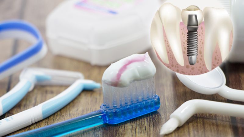 矯正器使用中の歯科ルールと自信を高める方法